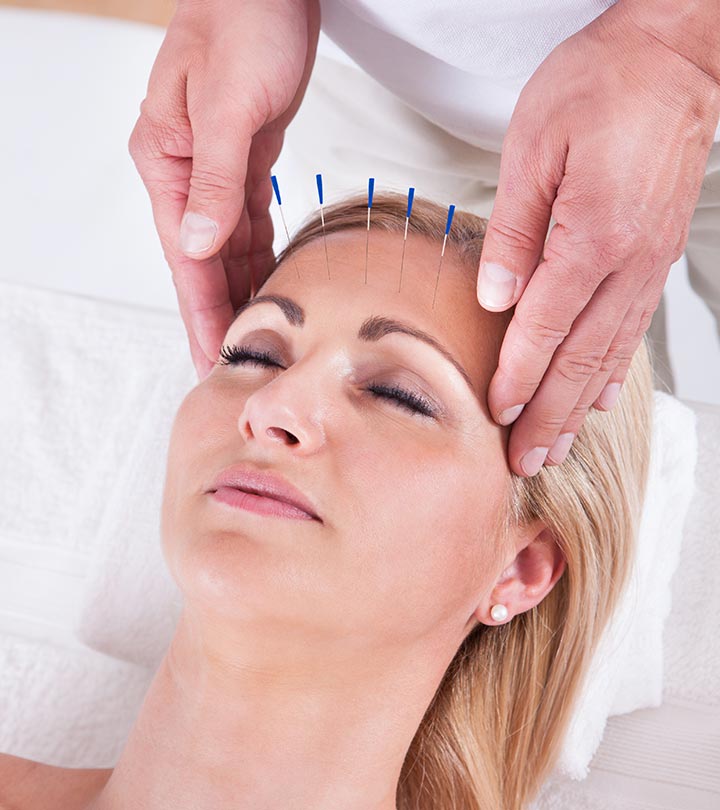 what-to-expect-from-facial-rejuvenation-acupuncture-awakenings-health